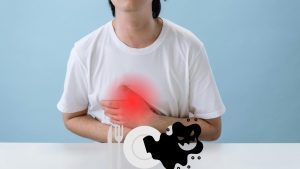 Richiamo per cibo contaminato